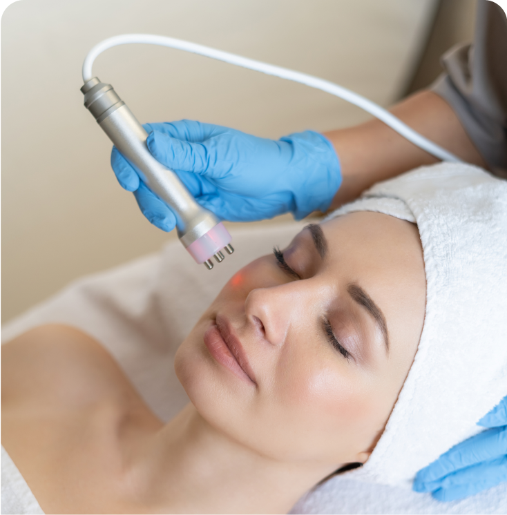 Laser Resurfacing