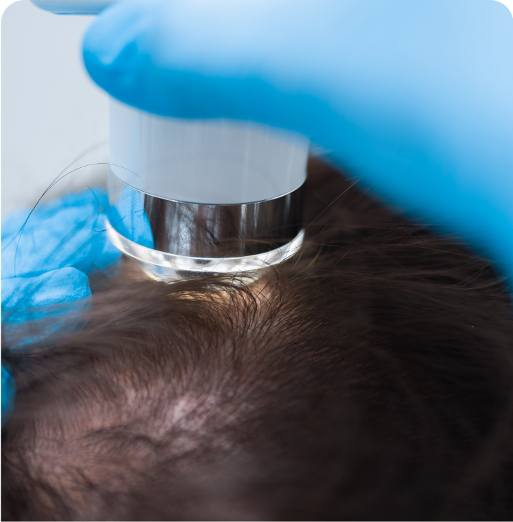 Hair Restoration